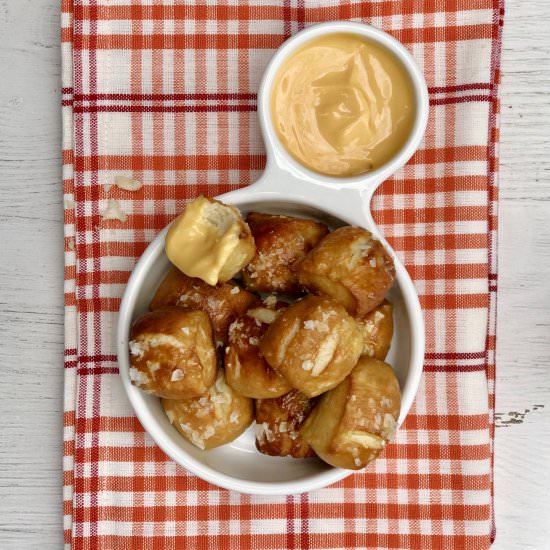 Homemade Soft Pretzel Bites - Recipe photo by simmerandsauce