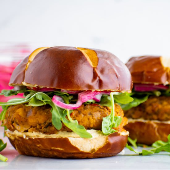 Vegan Chickpea Burgers - Recipe photo by thehangrychickpea