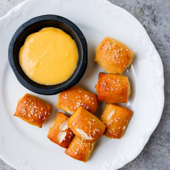 Pretzel Bites - Recipe photo by mealpreponfleek