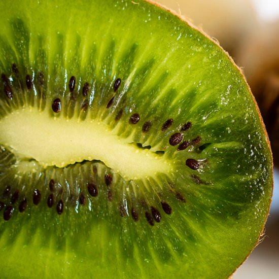 Can You Eat Kiwi Fruit Skin? - Recipe photo by myhealthdosage
