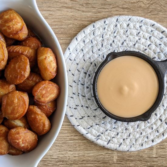 Soft Pretzel Bites & Beer Cheese - Recipe photo by thecandidcooks