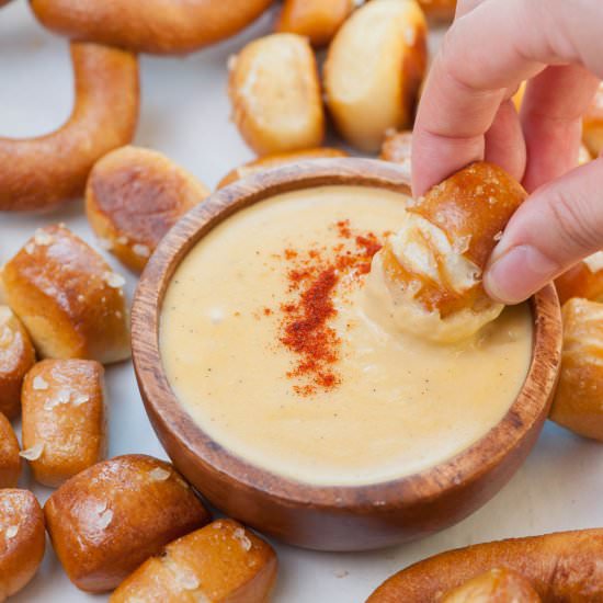 soft pretzel bites - Recipe photo by everyday-delicious.com